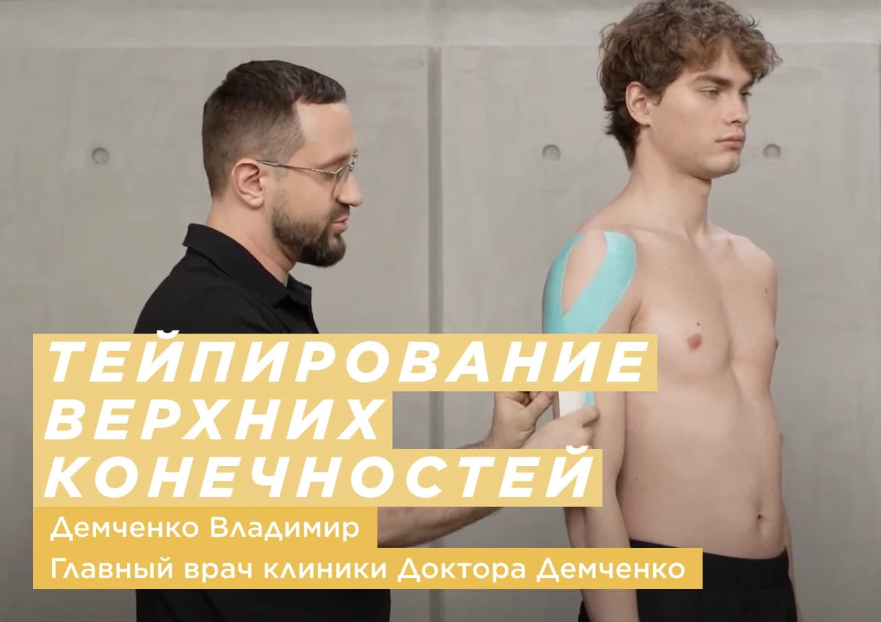 Тейпирование верхних конечностей 