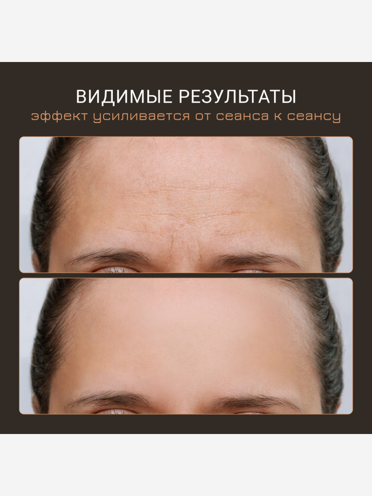 Микротоковый массажер для лица,против морщин, миостимуляция для лица Biolift Gezatone, розовый, m100s