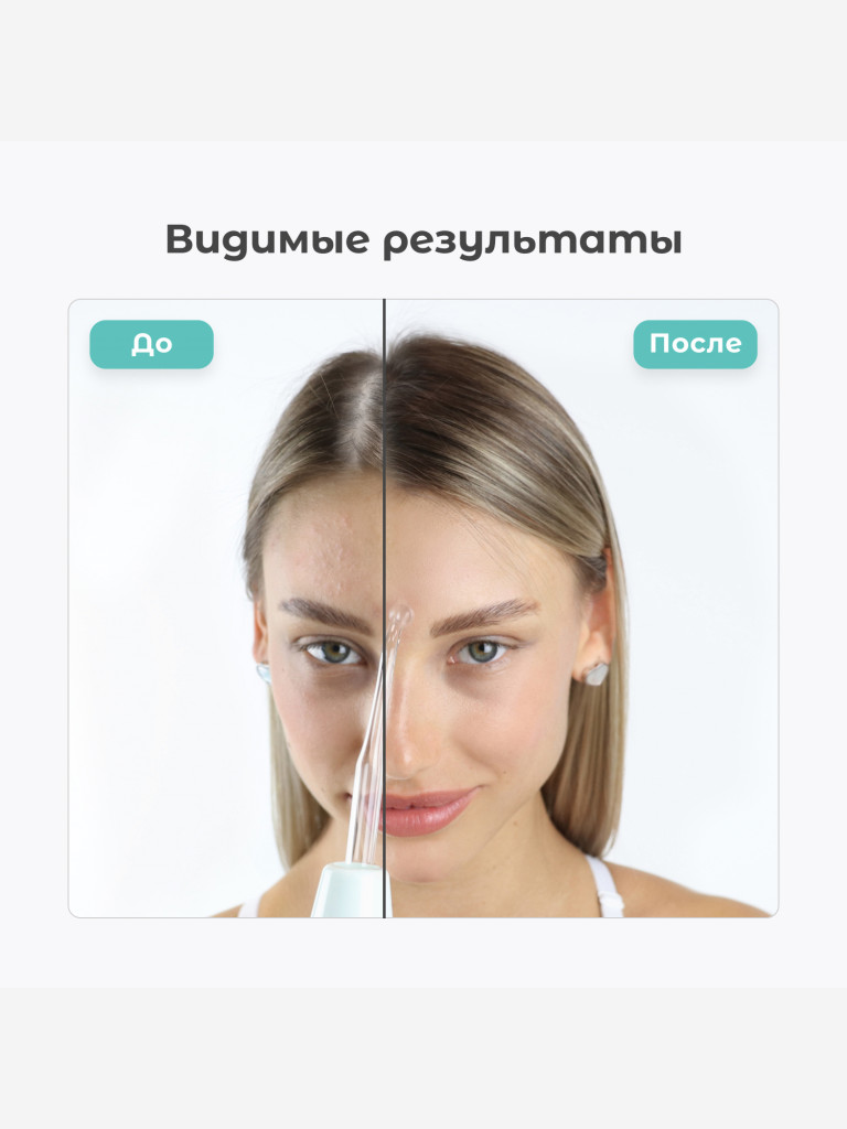 Оборудование для дарсонвальной терапии (4 насадки) Gezatone, белый, Biolift4-118
