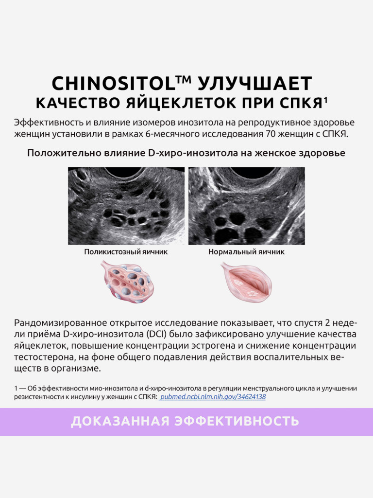 Инозитол UltraBalance для нормализации женского гормонального фона, 60 капсул