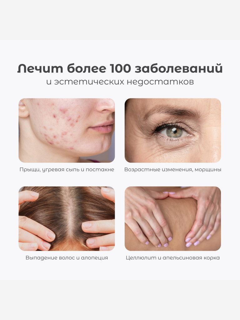 Оборудование для дарсонвальной терапии (4 насадки) Gezatone, белый, Biolift4-118