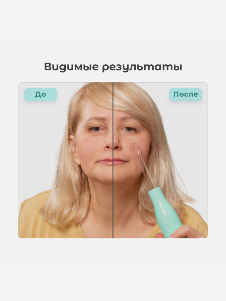 Оборудование для дарсонвальной терапии (5 насадок) Gezatone, бирюзовый, BP-7000