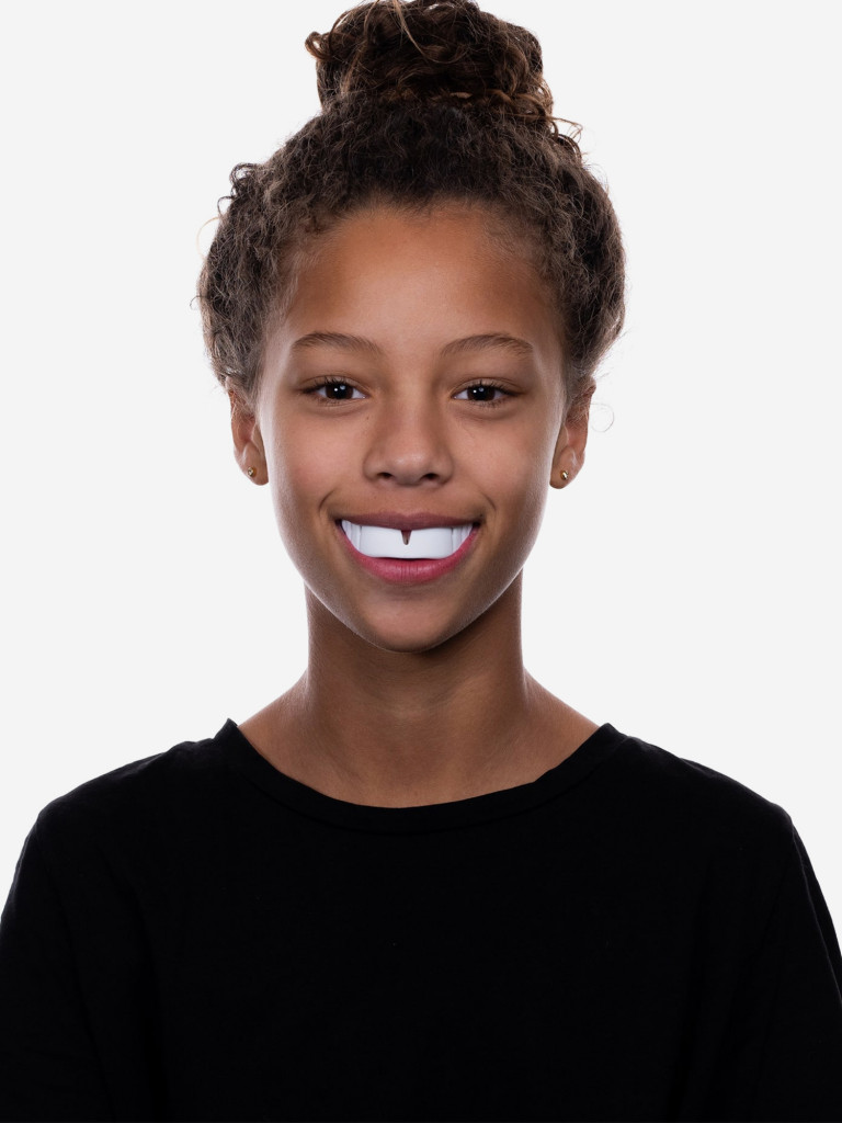 Детская боксерская капа, спортивная, однослойная защитная для зубов OPRO Snap-Fit - White