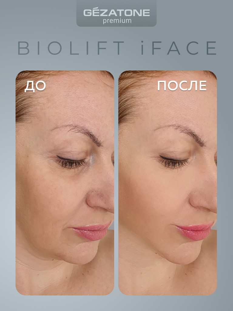 Массажер-маска миостимулятор для лица Biolift iFace, Gezatone